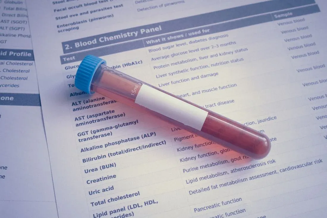 Tubo de coleta de sangue sobre um painel de exames bioquímicos