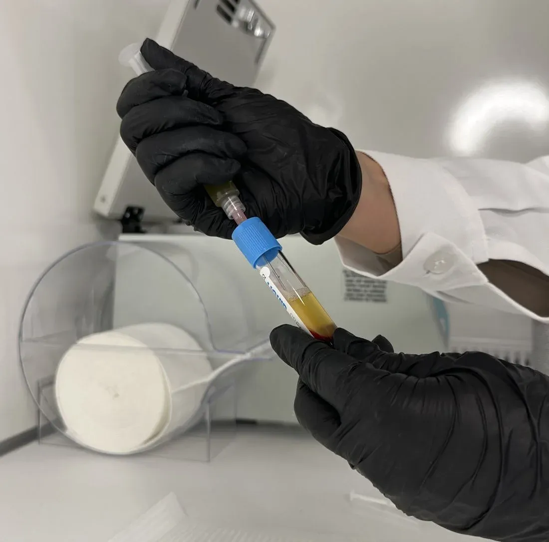 Amostra de urina em tubo sendo manipulada em laboratório
