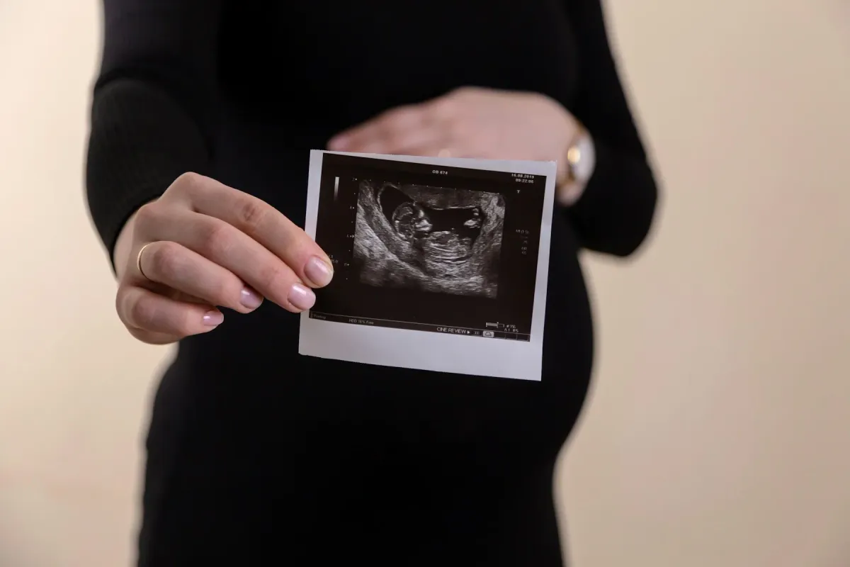 Gestante segura a imagem impressa de um ultrassom diante da barriga