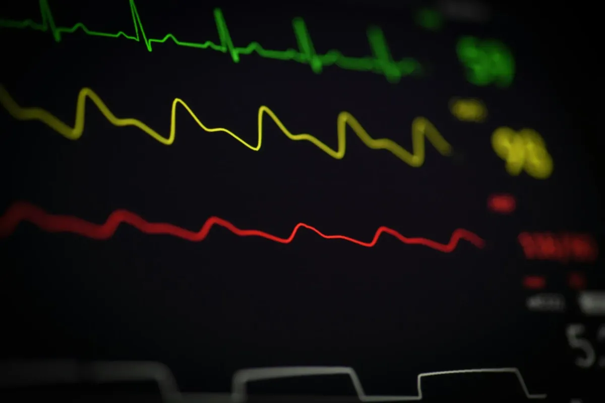 Monitor cardíaco com traçados de ECG e sinais vitais em tela escura