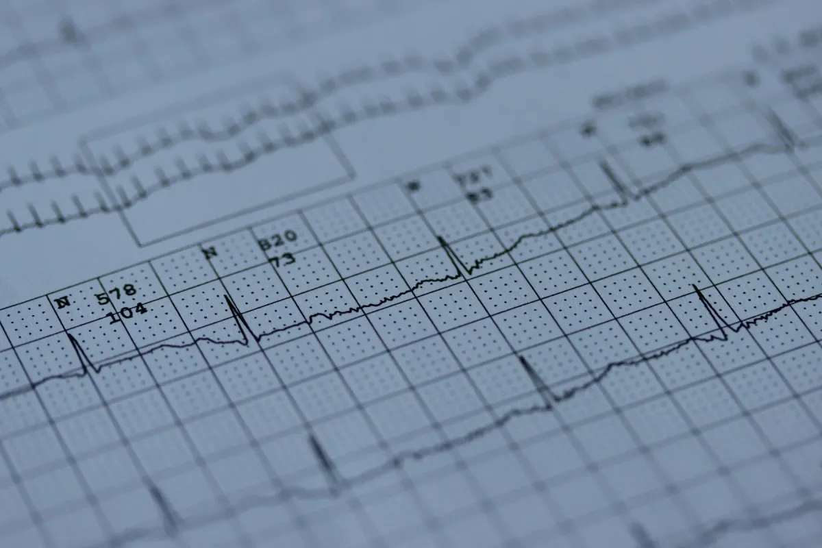 Traçado de eletrocardiograma impresso em papel quadriculado