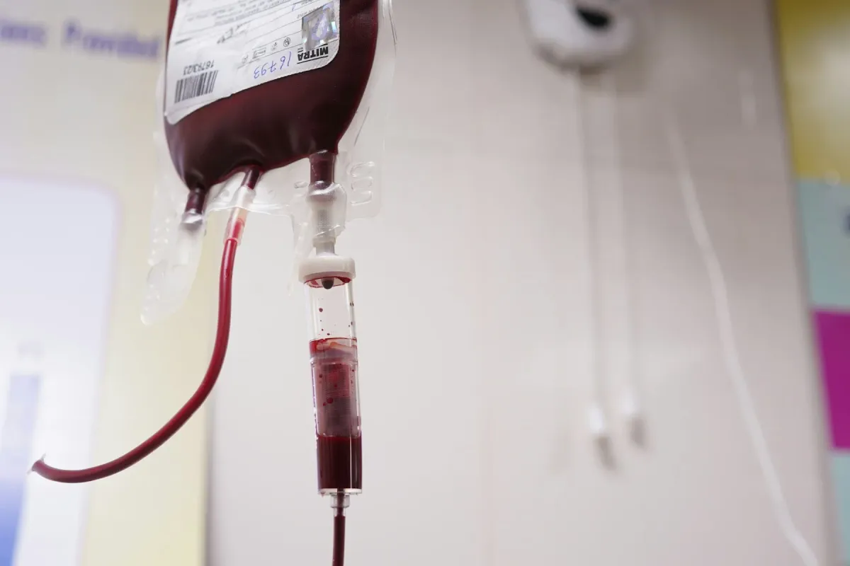 Bolsa de hemocomponente com equipo de transfusão pendurada em ambiente hospitalar