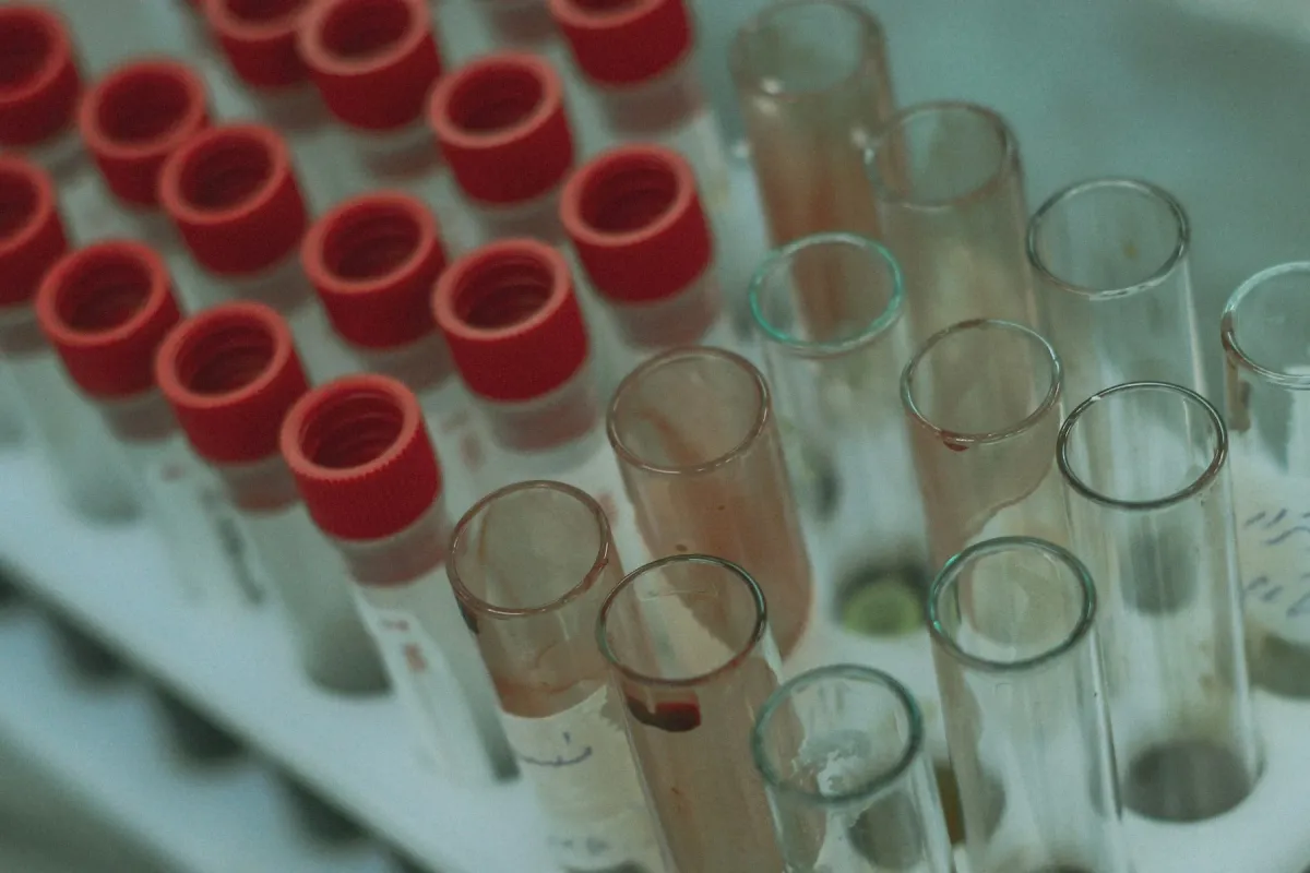 Tubos de coleta de sangue com tampas vermelhas organizados em estante