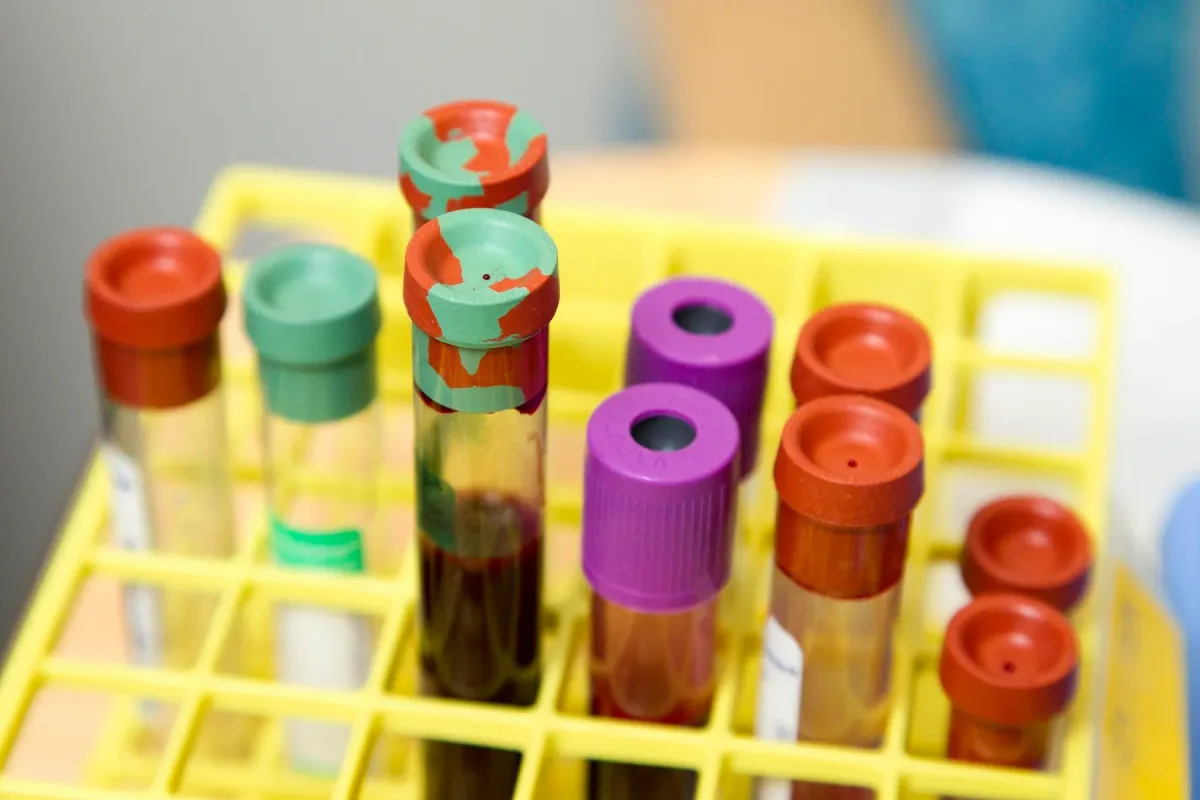 Tubos de coleta de sangue com tampas coloridas em suporte amarelo de laboratório