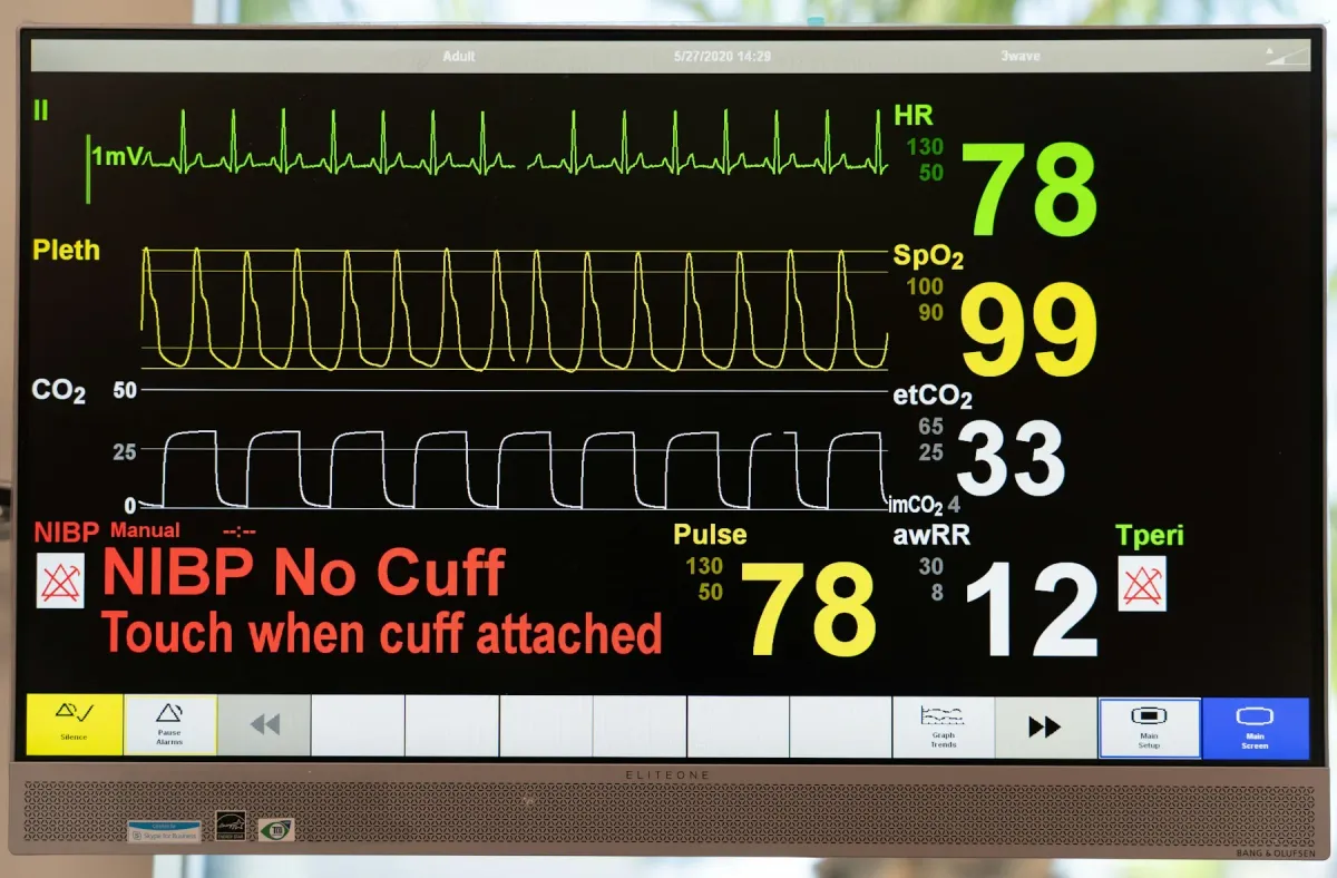 Monitor de sinais vitais com traçado de ECG, pletismografia, capnografia e valores numéricos