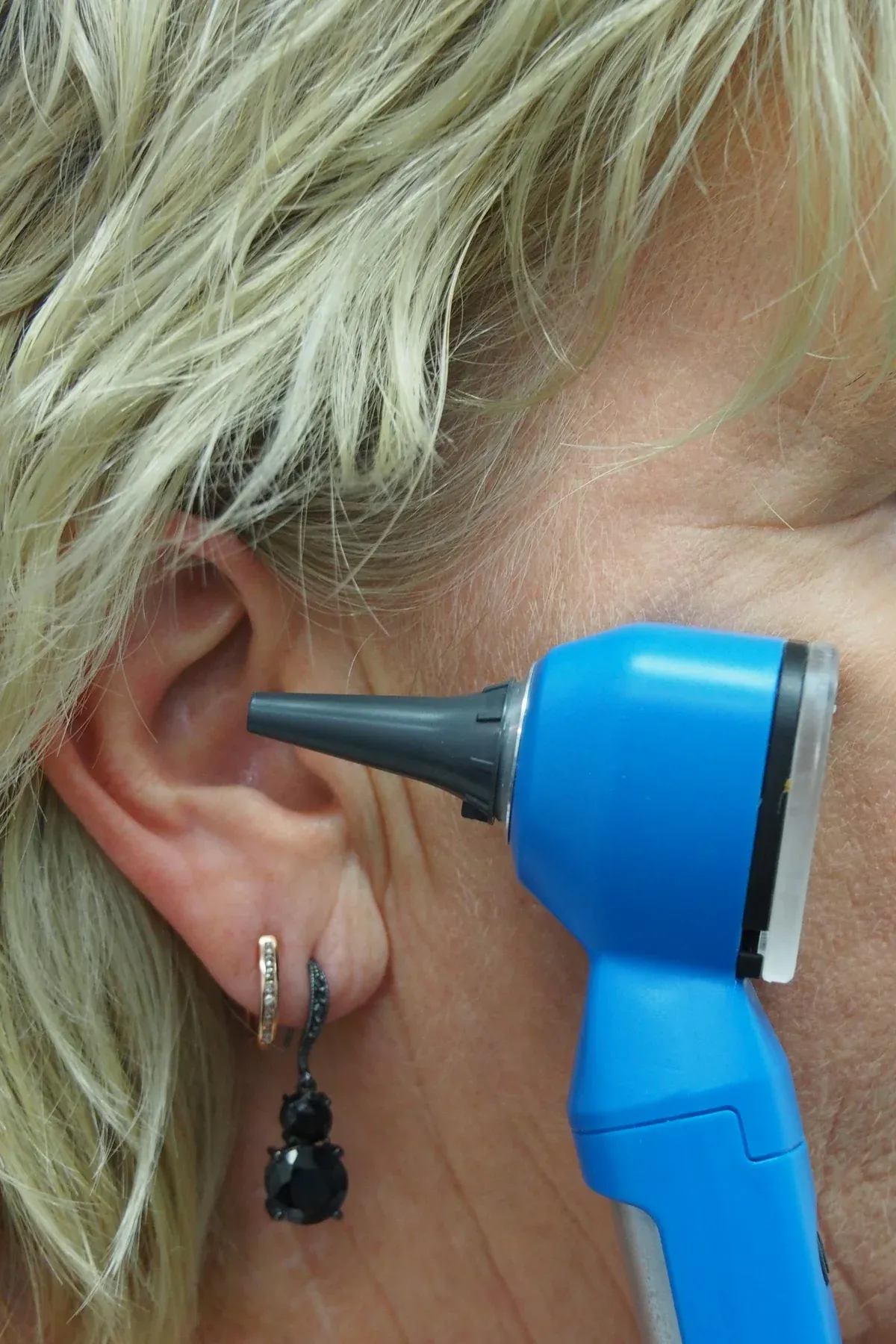 Médico examina o ouvido de uma paciente com um otoscópio azul