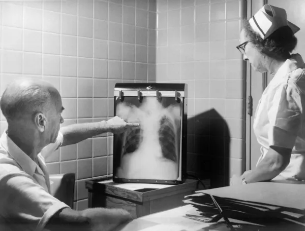 Médico e enfermeira analisam uma radiografia de tórax em preto e branco