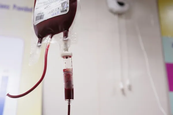 Bolsa de hemocomponente com equipo de transfusão pendurada em ambiente hospitalar