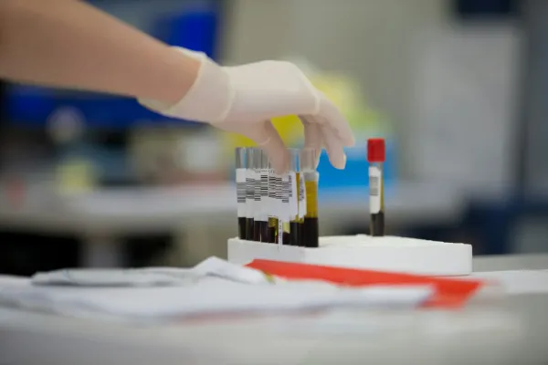 Mão enluvada manipula tubos de coleta de sangue em bancada de laboratório