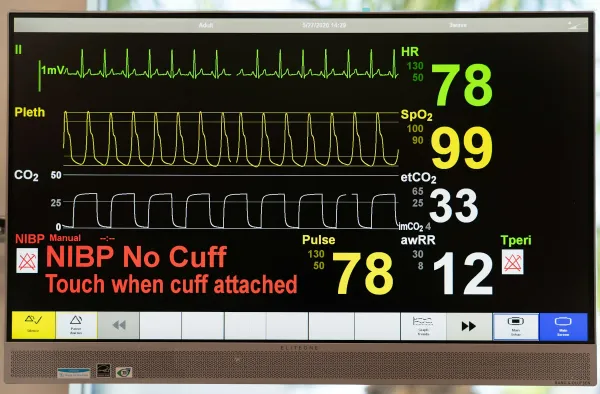 Monitor de sinais vitais com traçado de ECG, pletismografia, capnografia e valores numéricos